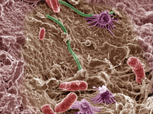 Soil microbes (Photo: Courtesy of Pacific Northwest National Laboratory)